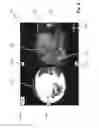 Fig. 08 - Method and device for displaying a first image and a second image of an object