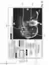 Fig. 10 - Method and device for displaying a first image and a second image of an object