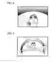 Fig. 04 - Imaging system to detect a trigger and select an imaging area
