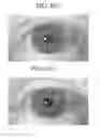 Fig. 05 - Apparatus for recognizing iris and operating method thereof
