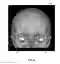 Fig. 03 - System and method for generating a reference plane of a head