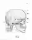 Fig. 04 - System and method for generating a reference plane of a head