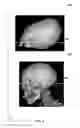 Fig. 05 - System and method for generating a reference plane of a head