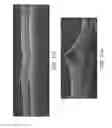 Fig. 18 - Segmentation and identification of layered structures in images