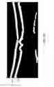 Fig. 22 - Segmentation and identification of layered structures in images