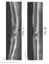 Fig. 23 - Segmentation and identification of layered structures in images
