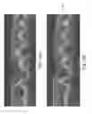 Fig. 24 - Segmentation and identification of layered structures in images