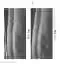 Fig. 27 - Segmentation and identification of layered structures in images