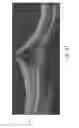 Fig. 34 - Segmentation and identification of layered structures in images