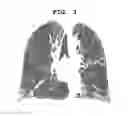 Fig. 04 - Method for quantifying medical image