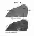Fig. 05 - Method for quantifying medical image