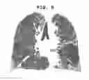 Fig. 09 - Method for quantifying medical image