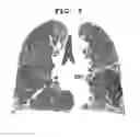 Fig. 10 - Method for quantifying medical image