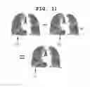 Fig. 12 - Method for quantifying medical image