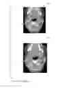 Fig. 06 - System and method for recalibrating a monochromatic image