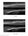 Fig. 12 - Methods and systems for transforming luminal images