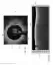 Fig. 03 - Systems and methods to detect and display endovascular features