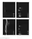 Fig. 05 - Systems and methods to detect and display endovascular features