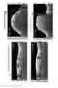 Fig. 08 - Systems and methods to detect and display endovascular features