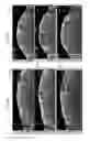 Fig. 09 - Systems and methods to detect and display endovascular features