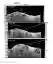 Fig. 10 - Systems and methods to detect and display endovascular features