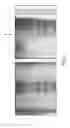 Fig. 03 - Registration system for registering an imaging device with a tracking device