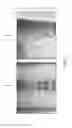 Fig. 04 - Registration system for registering an imaging device with a tracking device