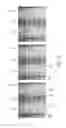Fig. 16 - Registration system for registering an imaging device with a tracking device