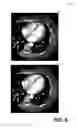 Fig. 08 - METHODS AND SYSTEMS FOR REAL-TIME IMAGE RECONSTRUCTION WITH ARBITRARY TEMPORAL WINDOWS