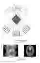 Fig. 01 - Tomography apparatus and method of reconstructing tomography image