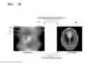 Fig. 03 - Tomography apparatus and method of reconstructing tomography image