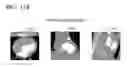 Fig. 16 - Tomography apparatus and method of reconstructing tomography image