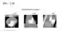 Fig. 18 - Tomography apparatus and method of reconstructing tomography image