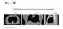 Fig. 19 - Tomography apparatus and method of reconstructing tomography image