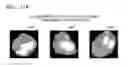 Fig. 20 - Tomography apparatus and method of reconstructing tomography image