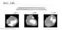 Fig. 24 - Tomography apparatus and method of reconstructing tomography image