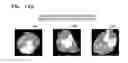 Fig. 25 - Tomography apparatus and method of reconstructing tomography image