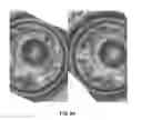 Fig. 09 - Method and system for three dimensional imaging and analysis