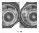 Fig. 10 - Method and system for three dimensional imaging and analysis