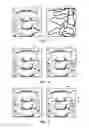 Fig. 05 - Real-time three-dimensional visualization of interventional medical devices