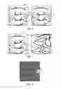 Fig. 06 - Real-time three-dimensional visualization of interventional medical devices