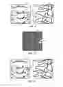 Fig. 07 - Real-time three-dimensional visualization of interventional medical devices