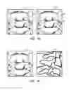 Fig. 09 - Real-time three-dimensional visualization of interventional medical devices