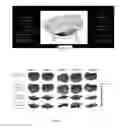 Fig. 04 - Valve modeling with dense chordae from medical scan data