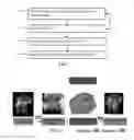 Fig. 05 - Valve modeling with dense chordae from medical scan data