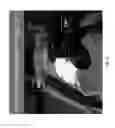 Fig. 23 - RADIATION SHIELDING DEVICE