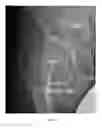 Fig. 24 - RADIATION SHIELDING DEVICE