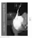Fig. 29 - RADIATION SHIELDING DEVICE