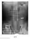 Fig. 30 - RADIATION SHIELDING DEVICE