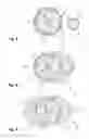Fig. 03 - USE OF A CABLE FOR THE TRANSMISSION OF AUDIO SIGNALS